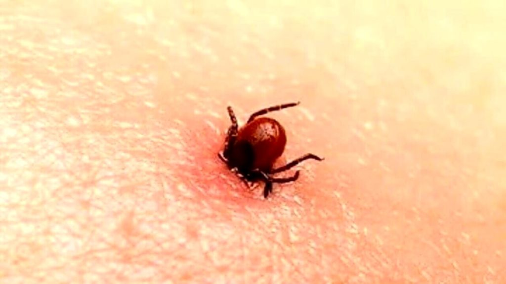 Le Zecche possono tramettere malattie mortali, ecco cosa fare in caso di morso