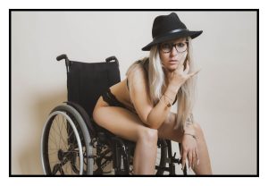 La fotografia per raccontare una disabilità "invisibile"