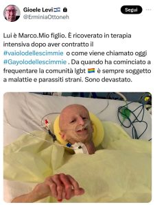 L'immagine di Sammy Basso usata per un post omofobo: indignazione e polemica sui social