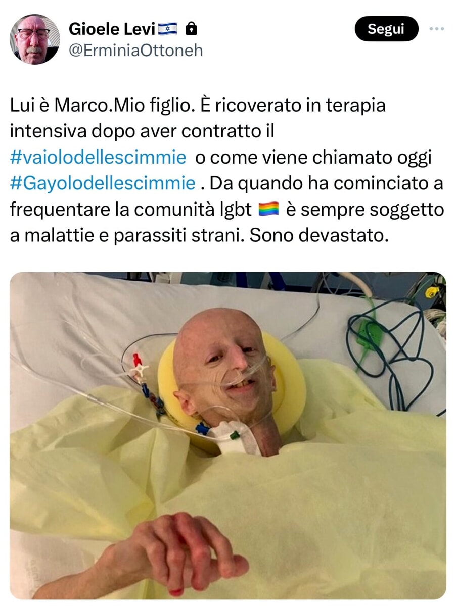 L'immagine di Sammy Basso usata per un post omofobo: indignazione e polemica sui social